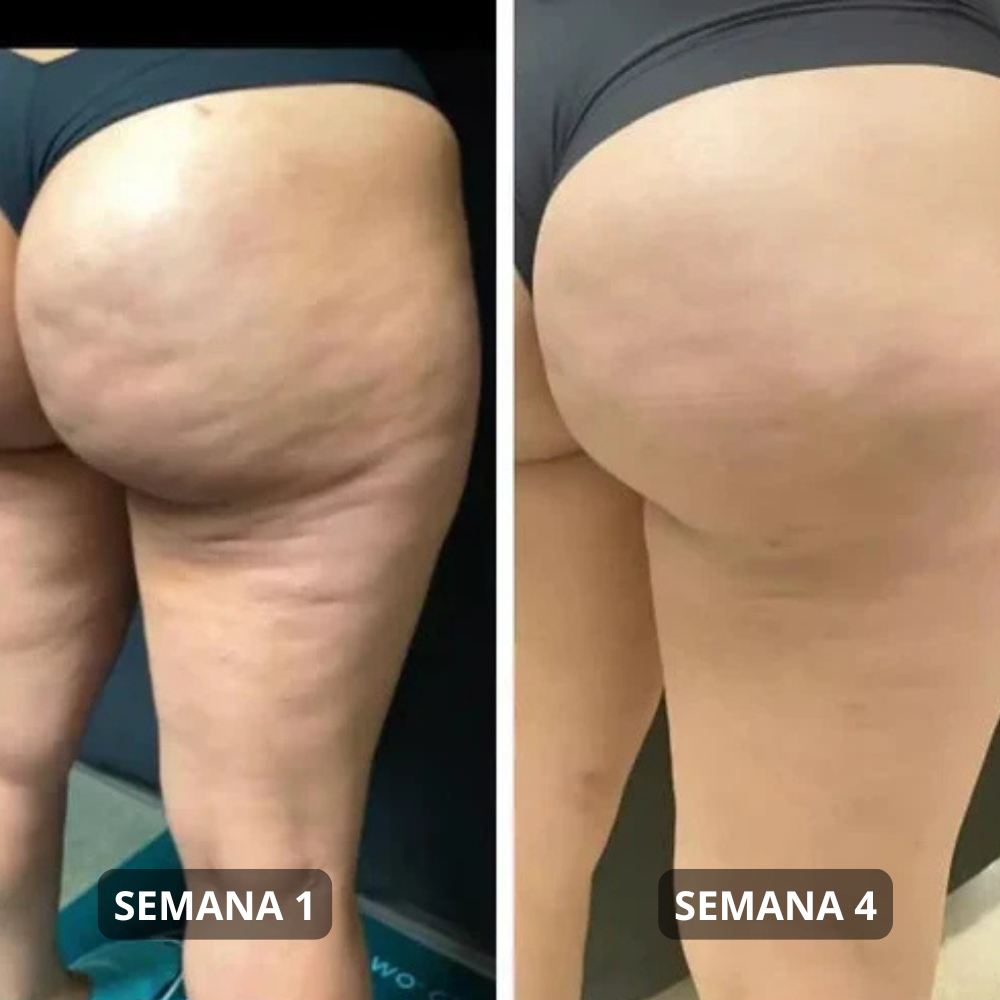 Parches Reafirmantes Anticelulitis